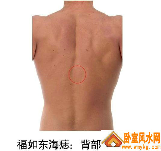 胎记生在背部正中间 胎记生在背部正中间