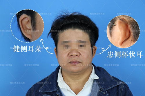 酒瓶椰子风水禁忌 酒瓶椰子风水禁忌